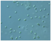 藍藻（植物プランクトン）（顕微鏡写真）