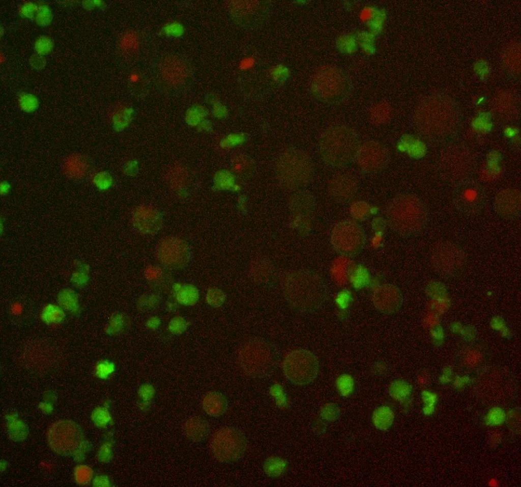 アポトーシス（細胞死）を起こしている”がん細胞”（蛍光画像）