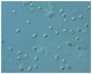 藍藻（植物プランクトン）
（顕微鏡写真）